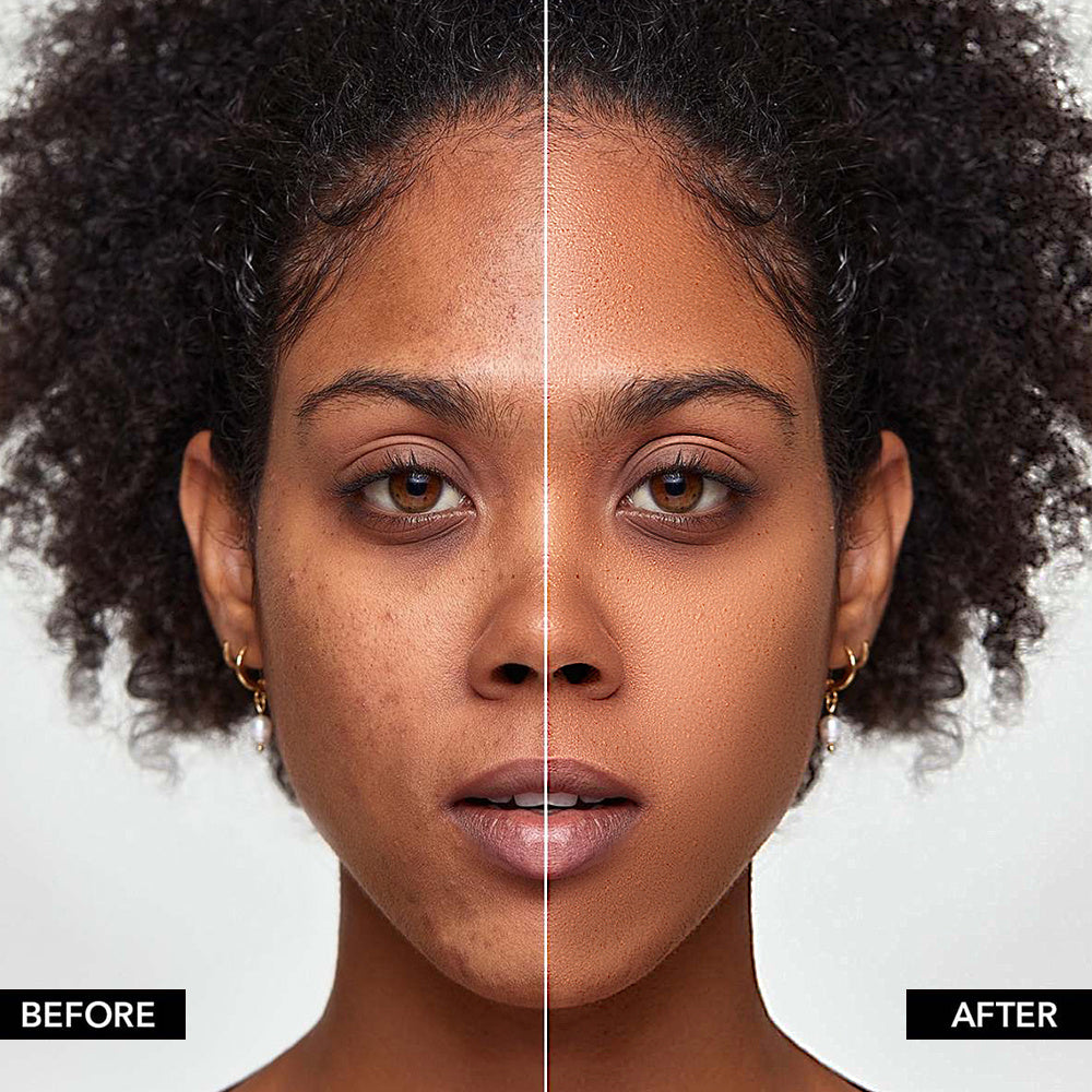 PHOFAY Full Coverage Foundation before and after application on skin complexion.